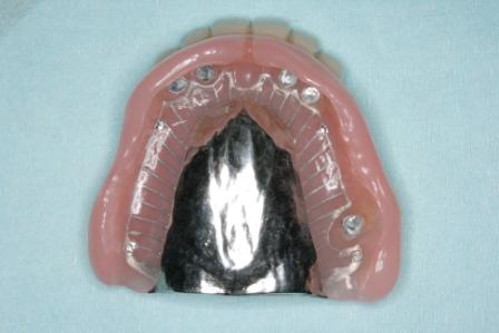 アタッチメント